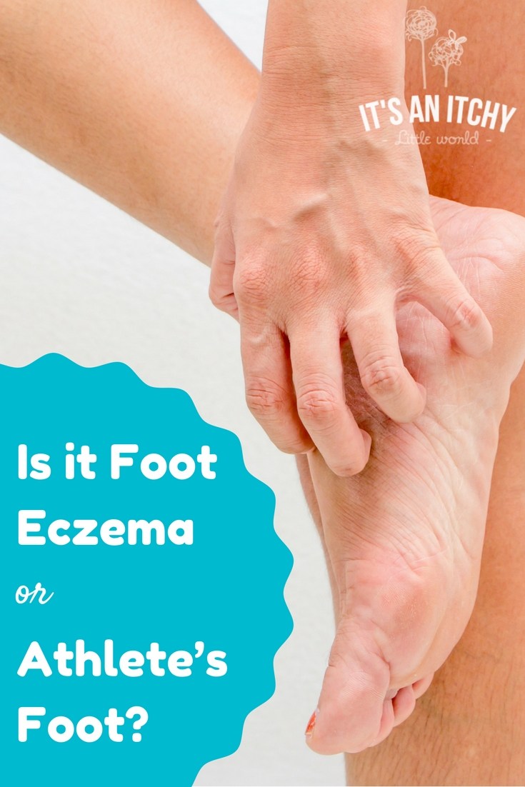 foot eczema - pinterest (1)
